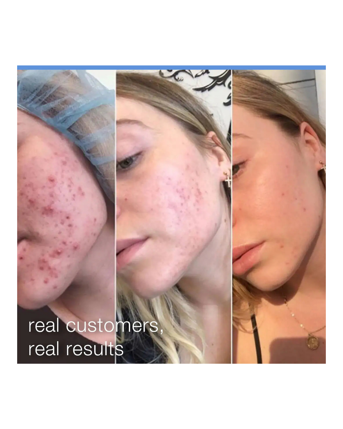 Daily Microfoliant Exfoliator