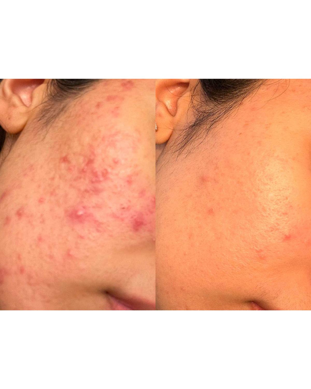 Antimicrobial Face Spray
