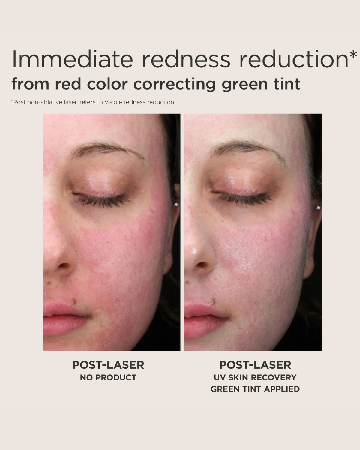 UV Skin Recovery Red Color Correcting Green Tint Broad Spectrum SPF 50