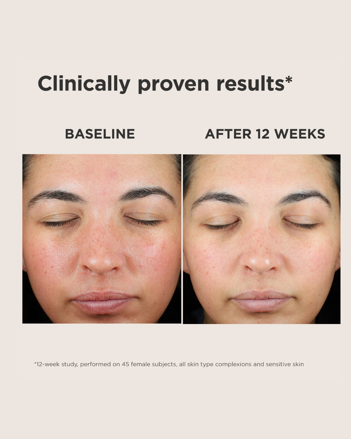 UV Skin Recovery Broad Spectrum SPF 50 Face Sunscreen