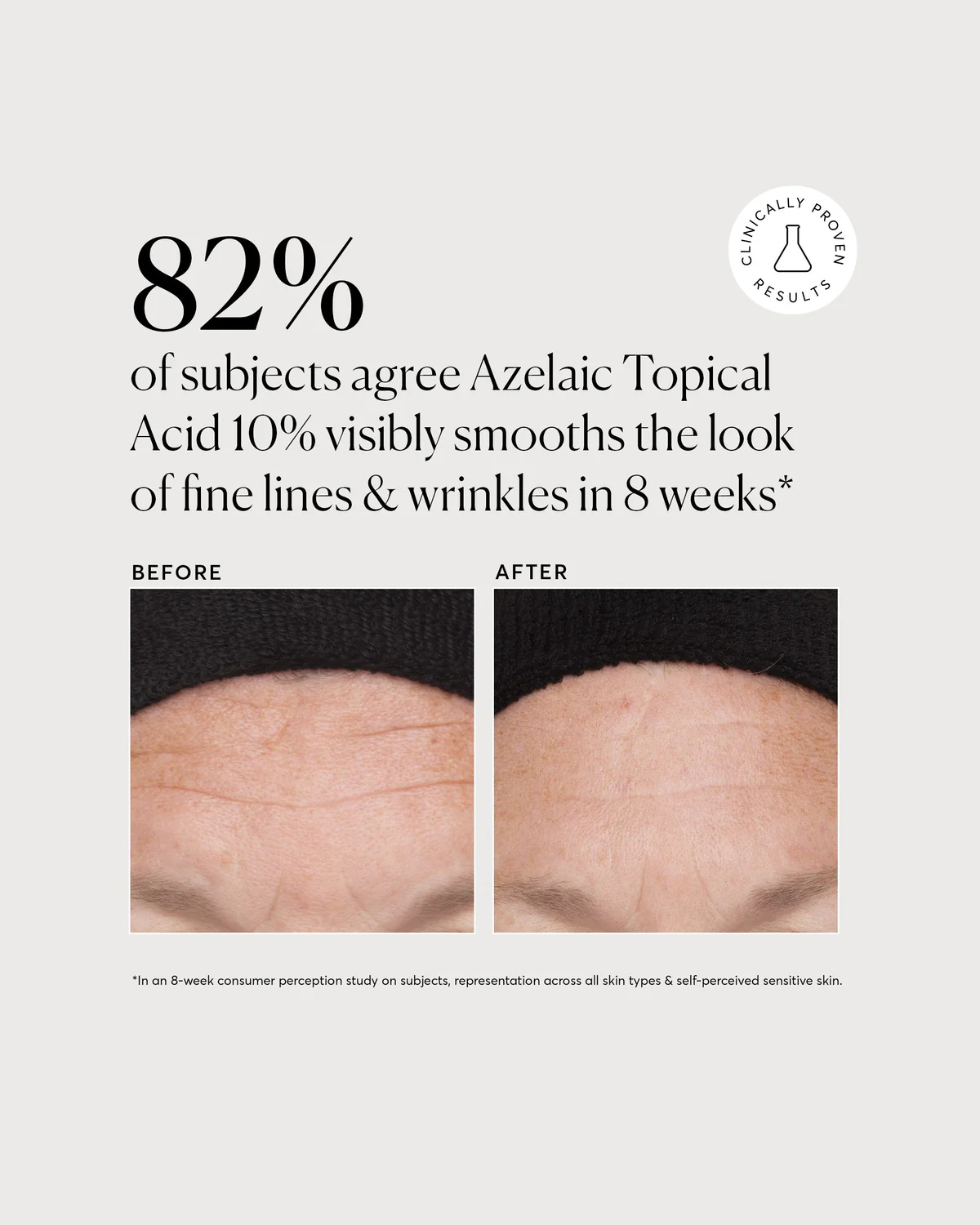 Azelaic Topical Acid 10%