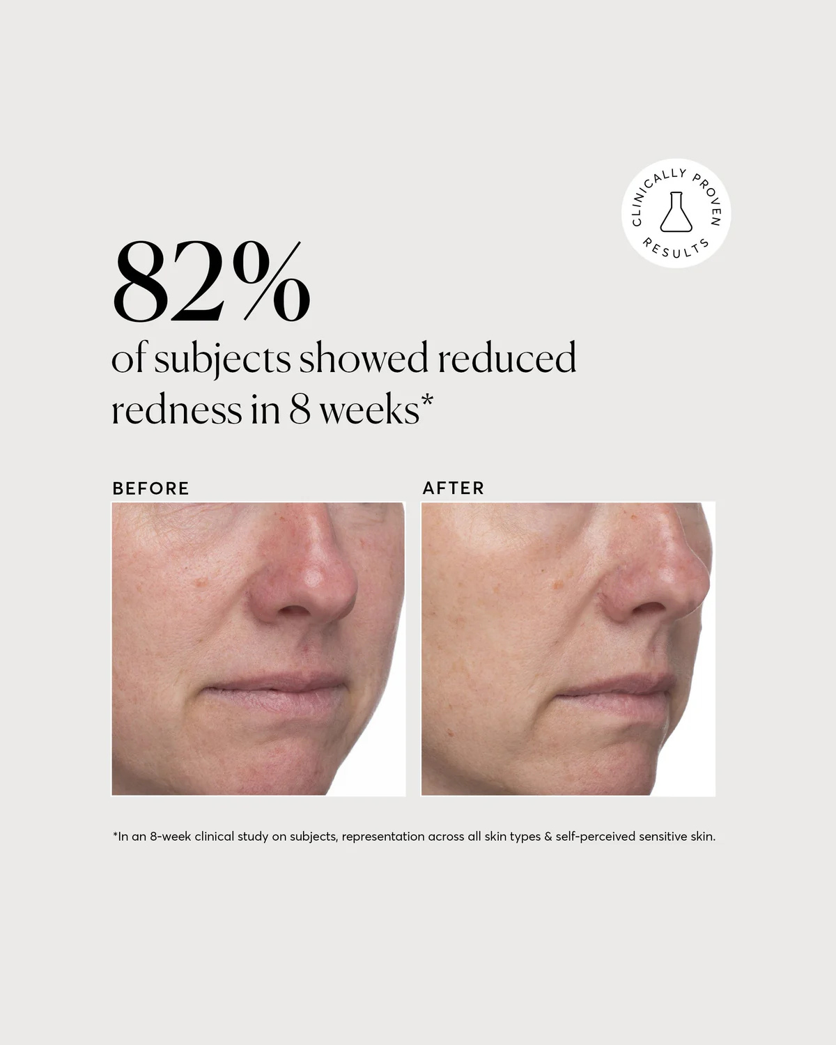 Azelaic Topical Acid 10%