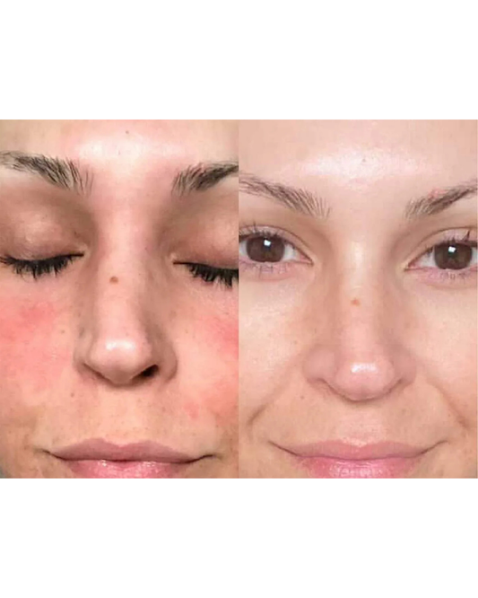 Antimicrobial Face Spray