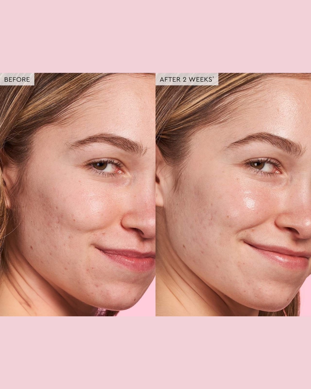  Watermelon Glow PHA + BHA Pore-Tight Toner