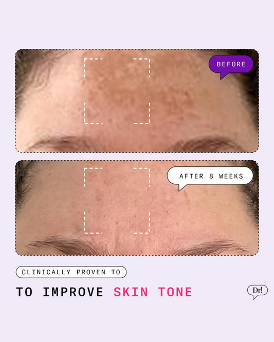 Major Fade Dark Spot Starter Kit